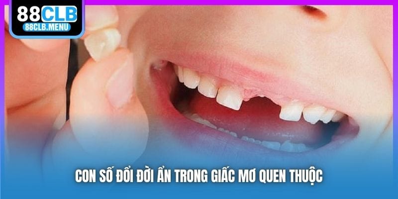 Nằm Mơ Gãy Răng Mang Điềm Báo Gì? Nên Đánh Đề Con Nào?