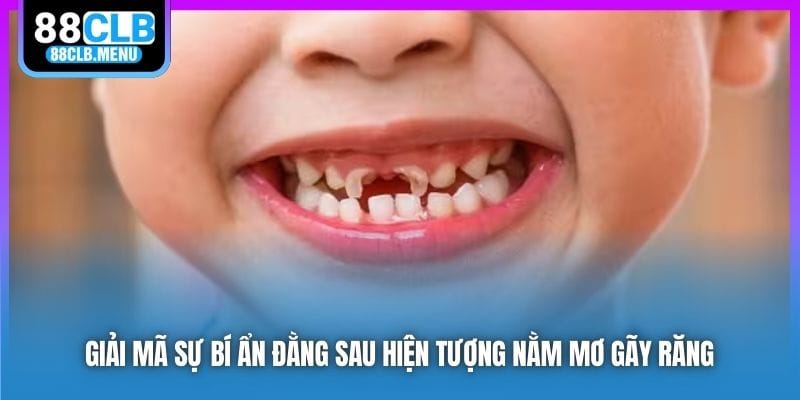 Nằm Mơ Gãy Răng Mang Điềm Báo Gì? Nên Đánh Đề Con Nào?